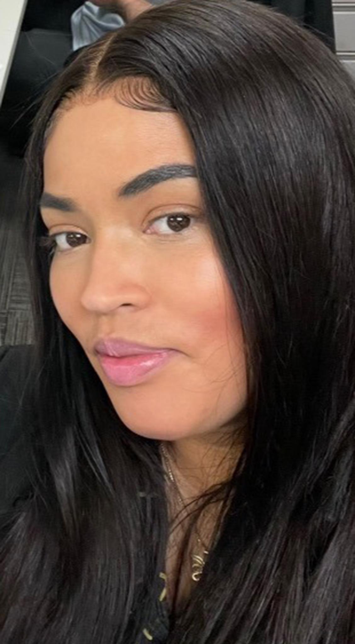 Woman dies after butt lift procedure in Colombia